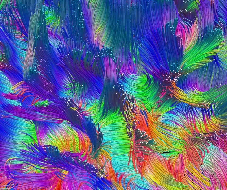 Neuropsicología